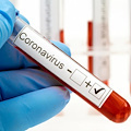 Coronavirus, un contagio ad Amalfi. Sindaco Milano: «È in ottima salute»
