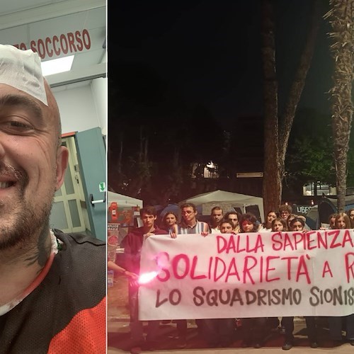 Chef Rubio aggredito a Roma<br />&copy; Chef Rubio su X