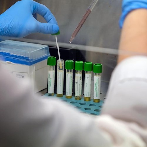 Coronavirus, cinque medici chiedono al Governo la revoca di «obblighi e divieti privi di legittimazione»
