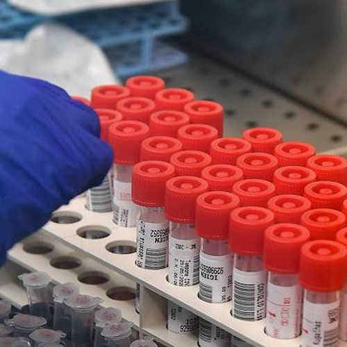 Coronavirus: "Msc Foundation" dona 30mila test per attività di screening in penisola sorrentina