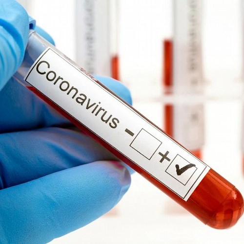 Coronavirus, un contagio ad Amalfi. Sindaco Milano: «È in ottima salute»