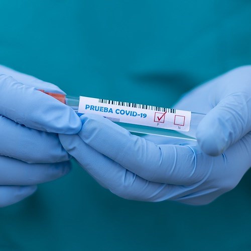 Covid, lieve aumento dei casi a Vico Equense: oltre 300 cittadini positivi 