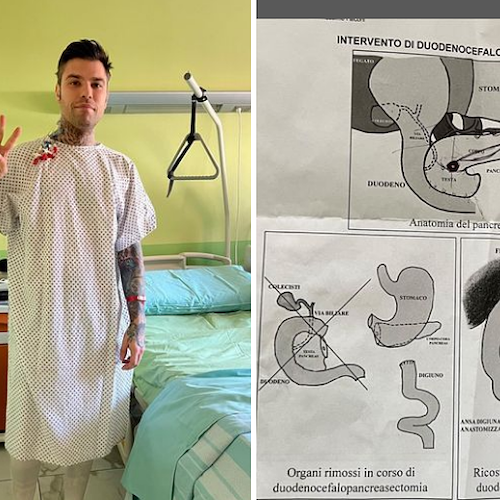 Fedez operato a Milano: «Ho un raro tumore neuroendocrino del pancreas»