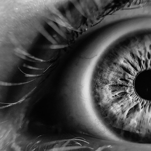 Impiantata per la prima volta in Italia una retina artificiale a 70enne non vedente