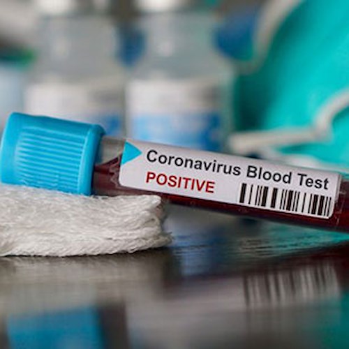 Nuovo caso di Coronavirus in Costa d’Amalfi, è un’anziana asintomatica di Cetara